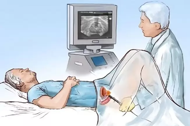 diagnosis of prostatitis